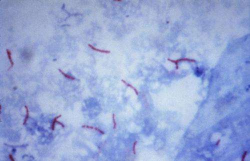 Scientists identify protein central to immune response against tuberculosis bacteria