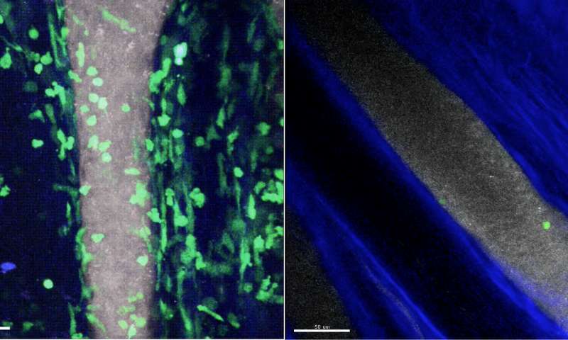 Tracking movement of immune cells identifies key first steps in inflammatory arthritis