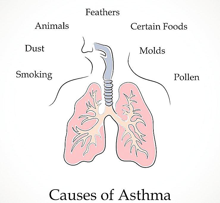 What is the the inducement of asthma