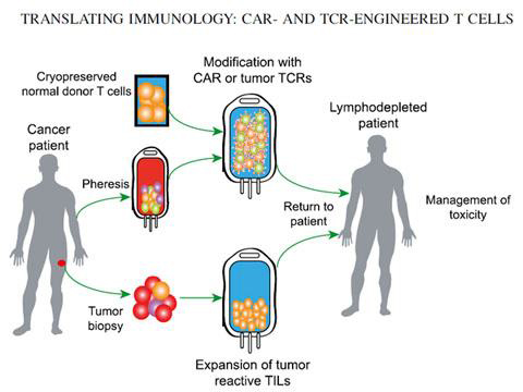 Scientists devise strategies to counteract T cell exhaustion in CAR T cancer therapies