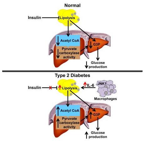 Newly discovered immune cell linked to type 1 diabetes