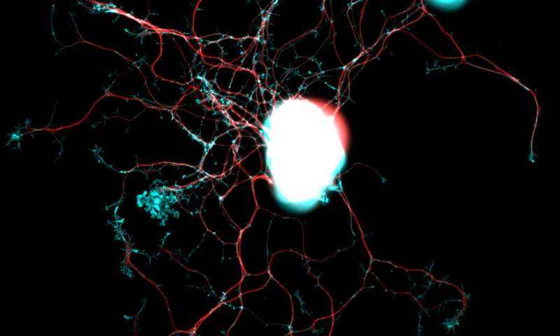 ADF/Cofilin-Mediated Actin Turnover Promotes Axon Regeneration in the Adult CNS