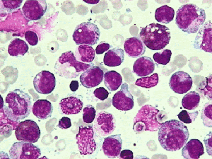 Salt-Inducible Kinase inhibition suppresses acute myeloid leukemia progression in vivo
