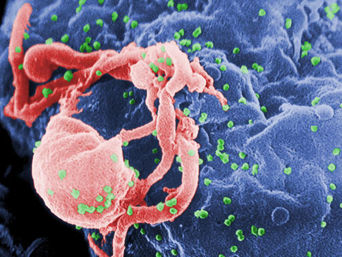 Researchers may have discovered where HIV takes refuge during antiretroviral treatment