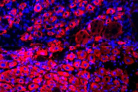 Rejuvenation of Three Germ Layers Tissues by Exchanging Old Blood Plasma With Saline-Albumin