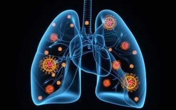 Pain researchers may know why COVID-19 spreads quickly in patients′ lungs