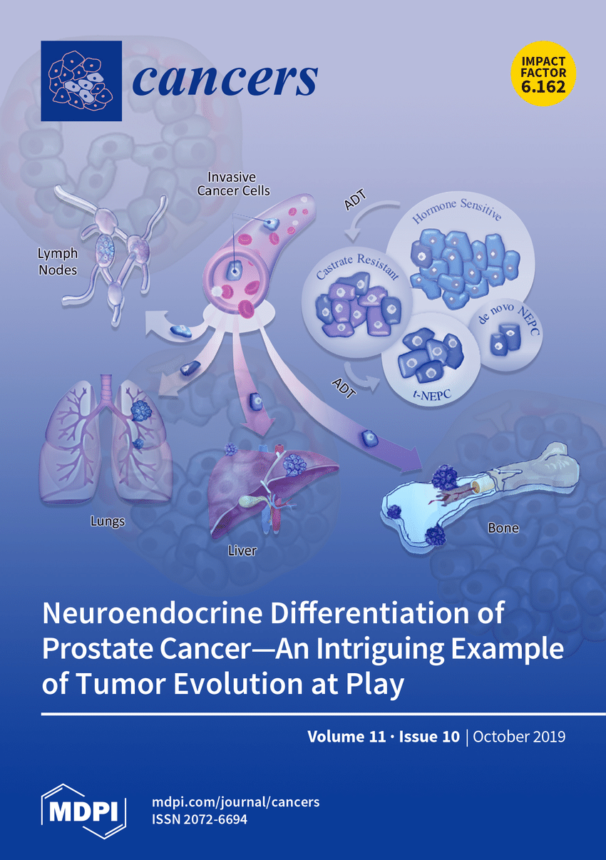 Circulating Exosomal Integrin β3 Is Associated with Intracranial Failure and Survival in Lung Cancer Patients Receiving Cranial Irradiation for Brain Metastases: A Prospective Observational Study