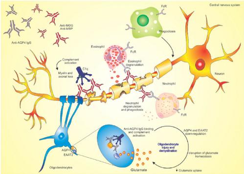 When encountering negative AQP4 in nmosd patients, what diseases should you consider