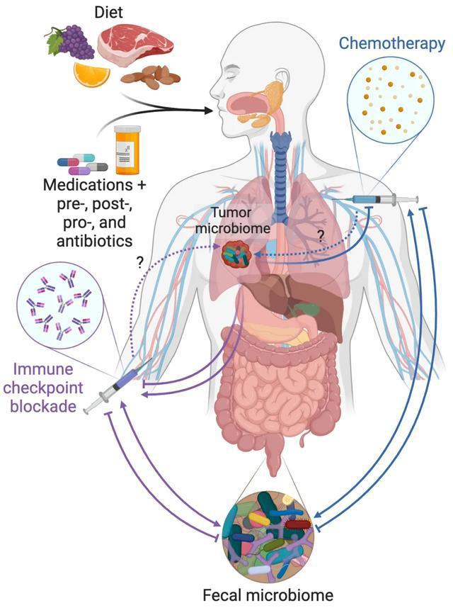 The microbiome and human cancer
