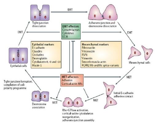 Research progress of interleukin-8 in epithelial mesenchymal transition of oral squamous cell carcinoma