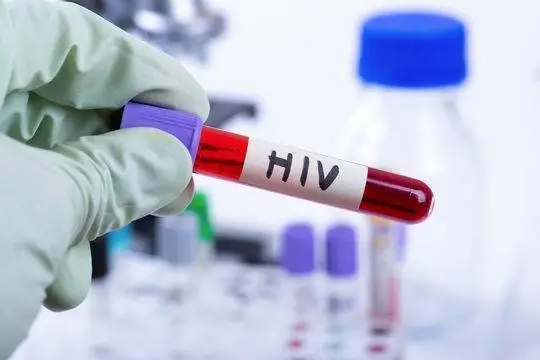 Researchers identify how two people controlled HIV after stopping treatment