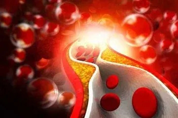 Correctly understand about residual cholesterol
