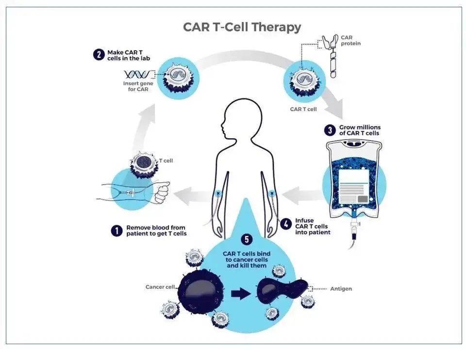 Researchers create single-cell framework to potentially enhance CAR T-cell therapy