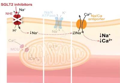 Six application experiences of sglt-2 inhibitors &quotescort" patients with heart failure