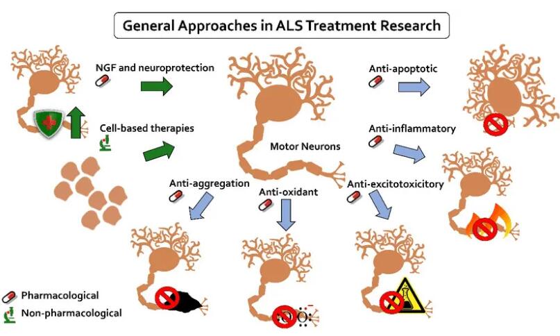Researchers identify possible treatment target for a type of sporadic ALS