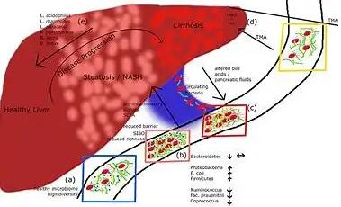 MRG15 aggravates non-alcoholic steaohepatitis progression by regulating the mitochondrial proteolytic degradation of TUFM